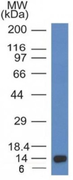 ALK/CD246 Antibody (ALK/1032) - Azide and BSA Free, Novus Biologicals 100
